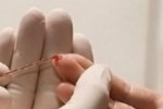 Над 400 души се изследваха за вируса на хепатит С в Стара Загора
