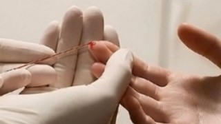 Над 400 души се изследваха за вируса на хепатит С в Стара Загора