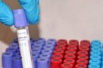 14 станаха случаите на заразени с коронавирус в Старозагорско
