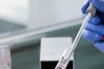 Нови 5 пациенти, заразени с COVID-19  са настанени в старозагорската болница