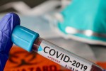 Няма новорегистрирани заболели от COVID-19 в Старозагорско за последното денонощие