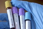 Нови 5 случая на заразени с коронавирус в Старозагорско