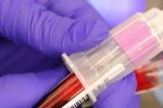 Нови 330 случая на заразени с COVID-19 за последното денонощие, един е в Старозагорско