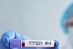 Пет новорегистрирани заболели от COVID-19 за последното денонощие