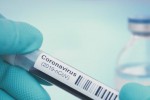 8 новорегистрирани заболели от COVID-19 в Старозагорско