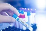Нови 11 положителни проби за COVID-19 са регистрирани в Старозагорско