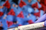 89 са регистрираните новозаразени с COVID-19 в Стара Загора
