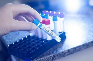 46 са новорегистрираните заболели от COVID-19 в Стара Загора