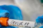 126 са новорегистрираните случаи на COVID-19 в Старозагорско