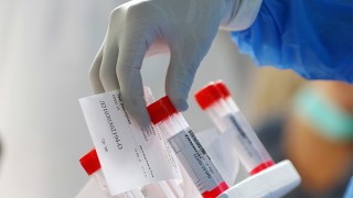 3 са новите положителни проби за COVID-19 в Старозагорско за изминалото денонощие
