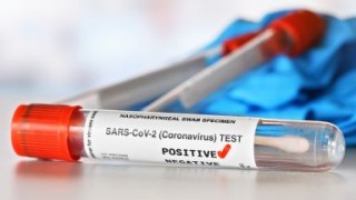 5 нови положителни проби за COVID-19 в Старозагорско