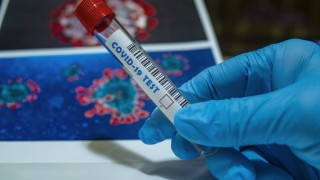205 са новите случаи на COVID-19 в Старозагорско