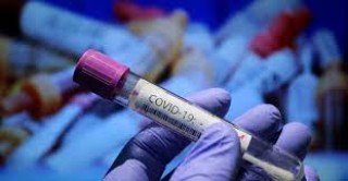 30 са новите положителни проби за COVID-19 в Старозагорско