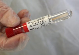 176 са новите положителни проби за COVID-19 в Старозагорско