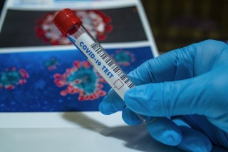 111 са новите случаи на COVID-19 в Старозагорско за последното денонощие