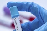 94 са новите случаи на COVID-19 в Старозагорско за последното денонощие