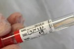 100 са новите случаи на COVID-19 в Старозагорско